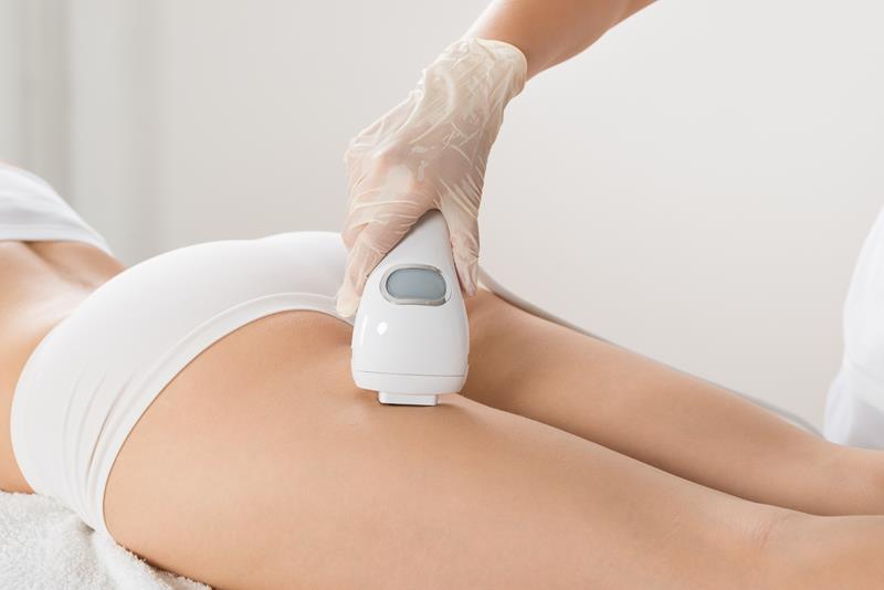 Laser Hair Removal in La Puente