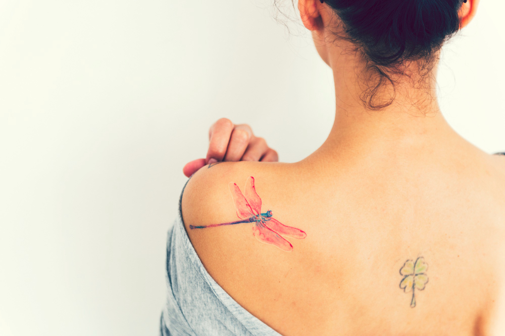 Tattoo Removal in La Puente